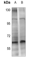 1 - Anti-CHK2 (Phospho-T432) Antibody AP59946