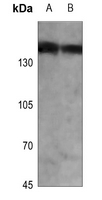 1 - Anti-PHLPP Antibody AP59947