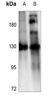 1 - Anti-ZO3 Antibody AP59948
