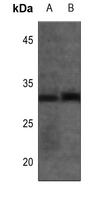 1 - Anti-CALY Antibody AP59949