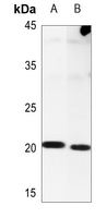1 - Anti-NIP7 Antibody AP59950