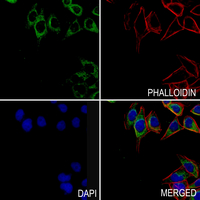 3 - Anti-STK31 Antibody AP59953