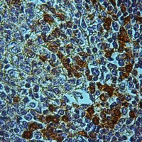 19 - Anti-STK31 Antibody AP59953