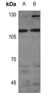 1 - Anti-STK31 Antibody AP59953