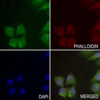 3 - Anti-ACER1 Antibody AP59956