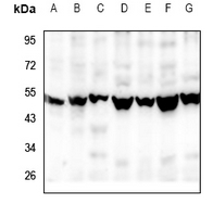 1 - Anti-RGMB Antibody AP59957