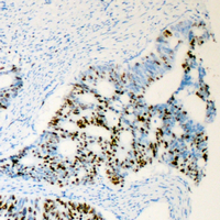 19 - Anti-Androgen Receptor (Phospho-S650) Antibody AP59958