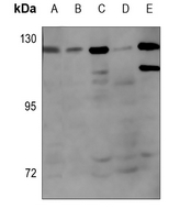 1 - Anti-Androgen Receptor (Phospho-S650) Antibody AP59958