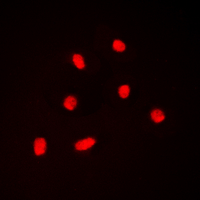 3 - Anti-BAF53A Antibody [KO/KD Validated] AP59959