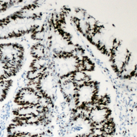 19 - Anti-BAF53A Antibody [KO/KD Validated] AP59959