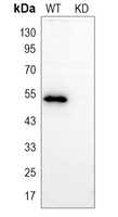 0 - Anti-BAF53A Antibody [KO/KD Validated] AP59959