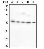 1 - Anti-BAF53A Antibody [KO/KD Validated] AP59959