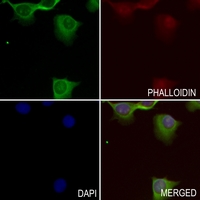 3 - Anti-Adrenomedullin Antibody AP59960