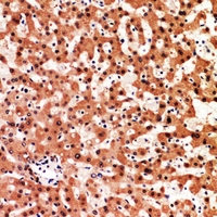 19 - Anti-Adrenomedullin Antibody AP59960