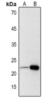 1 - Anti-Adrenomedullin Antibody AP59960