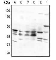 1 - Anti-Beta-3 Adrenergic Receptor Antibody AP59961