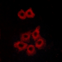 3 - Anti-APJ Antibody AP59962