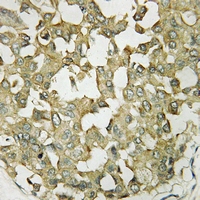 19 - Anti-APJ Antibody AP59962