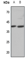 1 - Anti-APJ Antibody AP59962