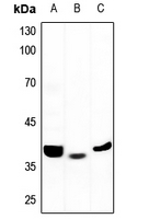 1 - Anti-ALDOB Antibody AP59963