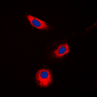 3 - Anti-Aldose Reductase Antibody AP59964