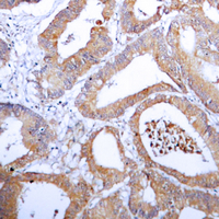 19 - Anti-Aldose Reductase Antibody AP59964