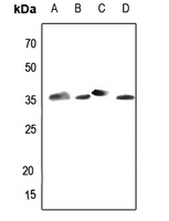 1 - Anti-Aldose Reductase Antibody AP59964