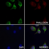 3 - Anti-ANT3 Antibody AP59965