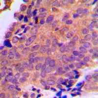 19 - Anti-ANT3 Antibody AP59965