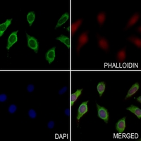 3 - Anti-Annexin A2 (Phospho-S26) Antibody AP59966