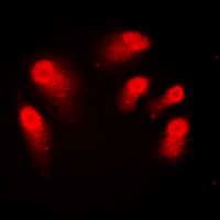 3 - Anti-AIRE Antibody AP59967