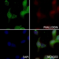 3 - Anti-Aquaporin 1 Antibody AP59968