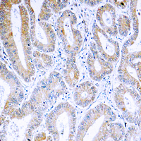 19 - Anti-ARF4 Antibody AP59969