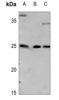 1 - Anti-ARF4 Antibody AP59969