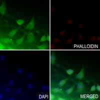 3 - Anti-ATF4 (Phospho-S245) Antibody AP59971