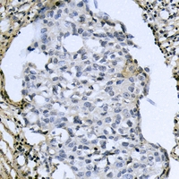 19 - Anti-ATF4 (Phospho-S245) Antibody AP59971