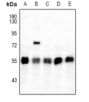 1 - Anti-ATF4 (Phospho-S245) Antibody AP59971