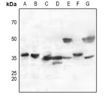 1 - Anti-CD298 Antibody AP59972