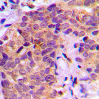19 - Anti-BAD (Phospho-S136) Antibody AP59973