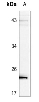 1 - Anti-BAD (Phospho-S136) Antibody AP59973