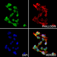 3 - Anti-BRCA1 (Phospho-S1524) Antibody AP59976