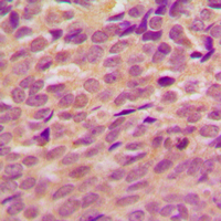 19 - Anti-BRCA1 (Phospho-S1524) Antibody AP59976