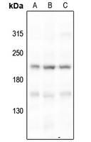 1 - Anti-BRCA1 (Phospho-S1524) Antibody AP59976