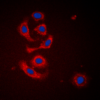3 - Anti-Calreticulin Antibody AP59977