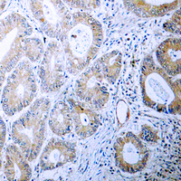19 - Anti-Calreticulin Antibody AP59977