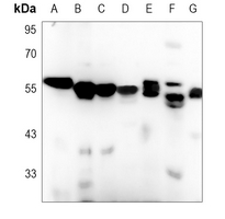 1 - Anti-Calreticulin Antibody AP59977