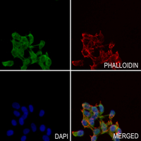 3 - Anti-Catalase (Phospho-Y386) Antibody AP59978