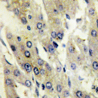 19 - Anti-Catalase (Phospho-Y386) Antibody AP59978