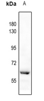 1 - Anti-Catalase (Phospho-Y386) Antibody AP59978
