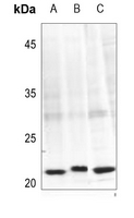 1 - Anti-Caveolin 1 (Phospho-Y14) Antibody AP59979
